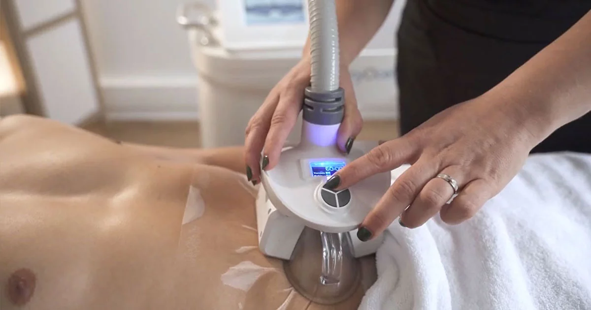 Soin de cryolipolyse Cryocell en cabine chez Sequoia Day Spa